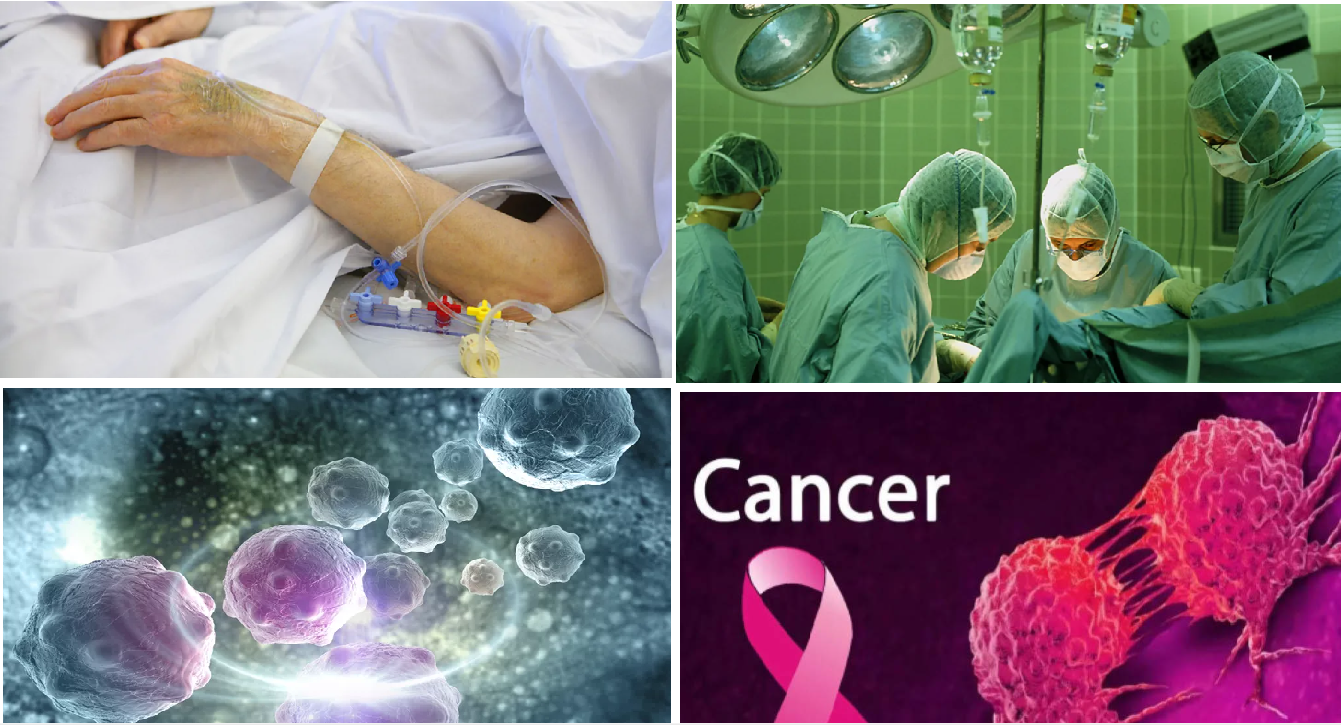 FUNDAMENTALS OF CANCER